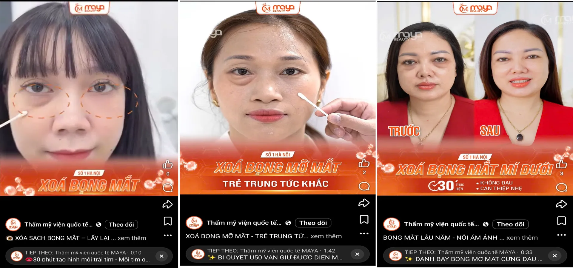 Phòng khám chuyên khoa thẩm mỹ MAYA, hay còn có tên gọi khác là Thẩm mỹ viện Quốc tế MAYA trực thuộc Công ty TNHH Thẩm mỹ viện Quốc tế MAYA và loạt quảng cáo có dấu hiệu vi phạm. so1