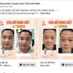 Quảng cáo dùng từ ‘số 1’, ‘nhất’: Thẩm mỹ viện Quốc tế MAYA dựa vào đâu để khẳng định?
